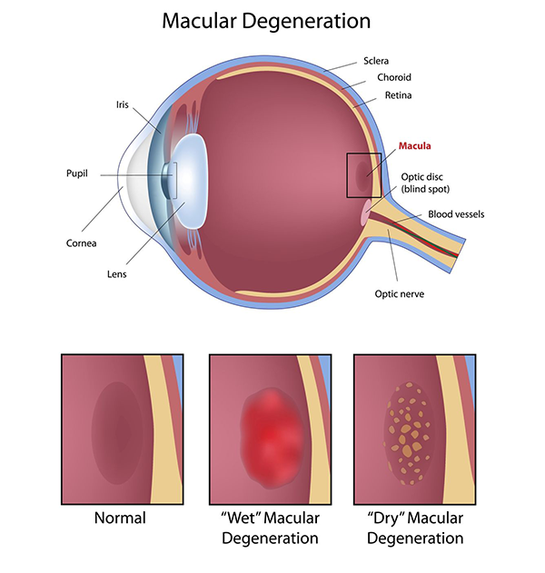 Optique Elegance | Macular Degeneration, Diabetic Eye Exams and Contact Lens Exams